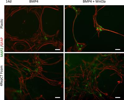 Recombinant Spider Silk Protein Matrices Facilitate Differentiation of Neural Stem Cells Into Mature and Functional Neurons